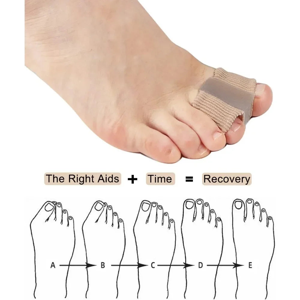 Adjustable Hallux Valgus Bunion Corrector